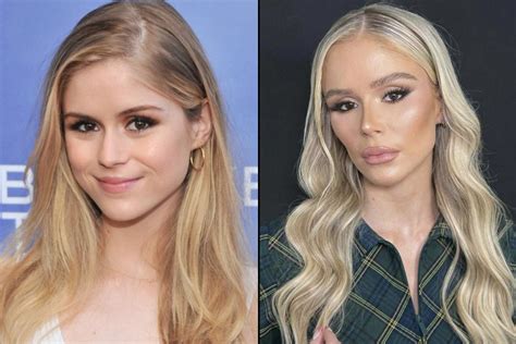 erin.moriarty plastic surgery|The Boys Star Erin Moriarty Responds To Plastic。